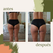 Cargar imagen en el visor de la galería, Celulitis y Reafirmación