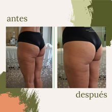 Cargar imagen en el visor de la galería, Celulitis y Reafirmación