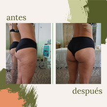 Cargar imagen en el visor de la galería, Celulitis y Reafirmación