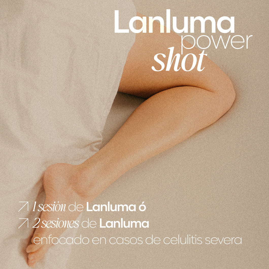Lanluma Power Shot