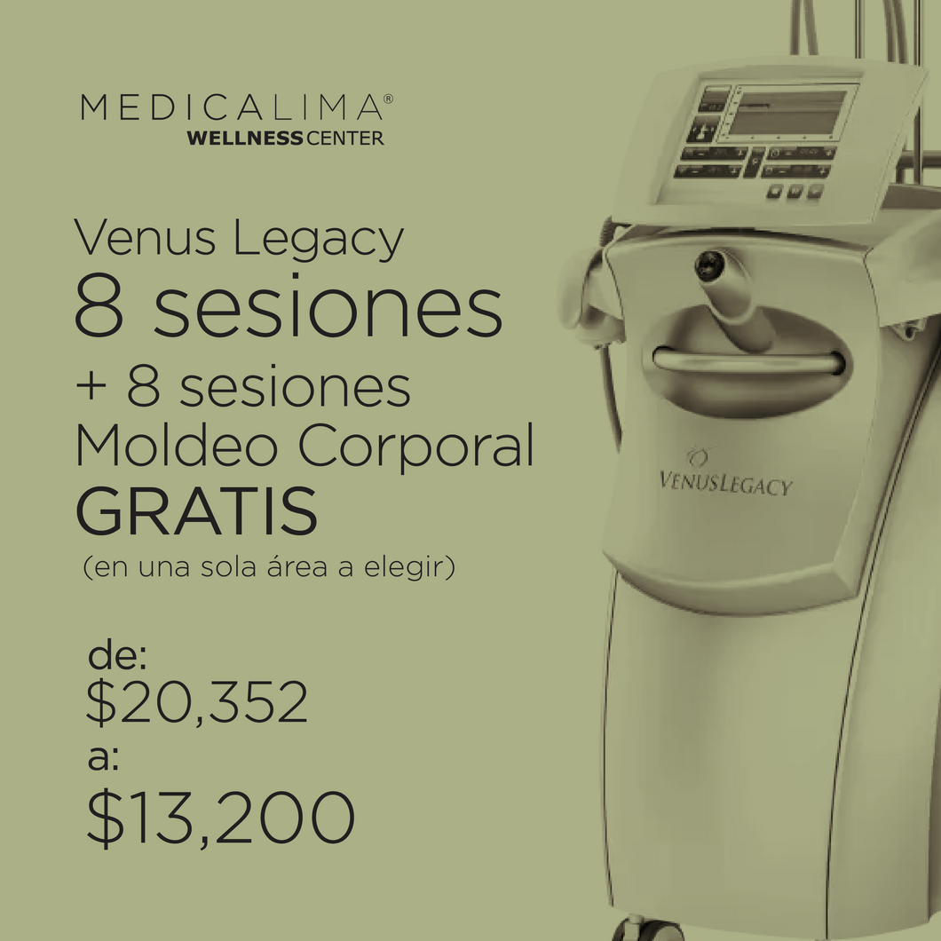Venus Legacy + Moldeo