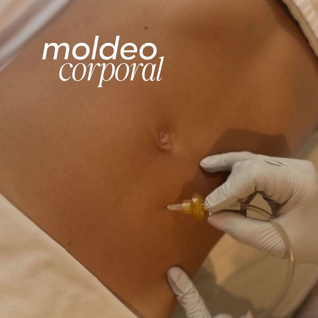 Moldeo Corporal